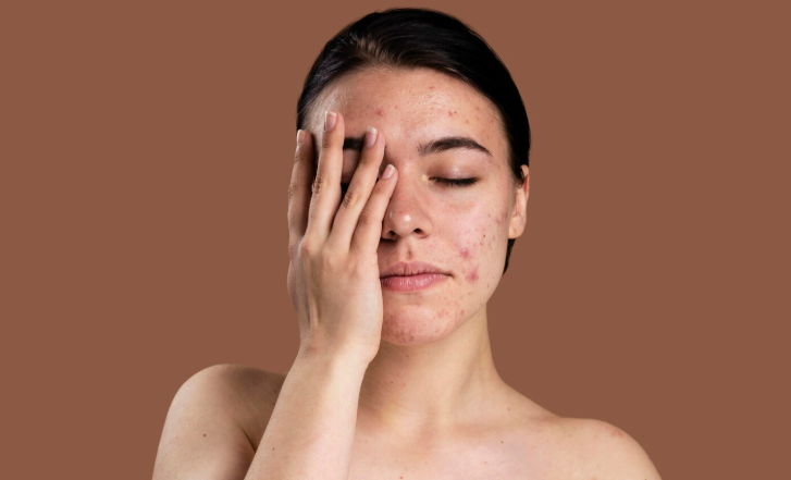 Skin Problem