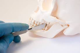 Maxillofacial Surgery