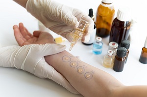Allergy & Patch Testing
